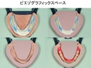鶴見大学先制医療研究センター 医療技術トレーニングシリーズ 高精度全部床義歯の製作 〜ピエゾグラフィ
