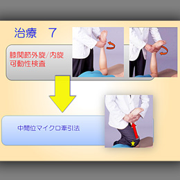 第3巻　膝関節の検査と治療(2)