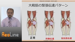 第3巻　鼠径部痛症候群