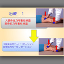 第2巻　膝関節の検査と治療(1)