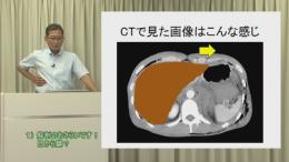生徒を守るための保健指導シリーズ お腹が痛い!(>_<) 知っていますか?「危ない腹痛の見分け方」