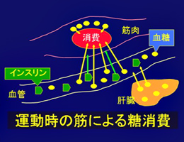 糖尿病に対する運動療法 : 概論