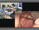 医療技術トレーニングシリーズ　これで解る!小児の過剰歯への対応　正中埋伏過剰歯の臨床的対応